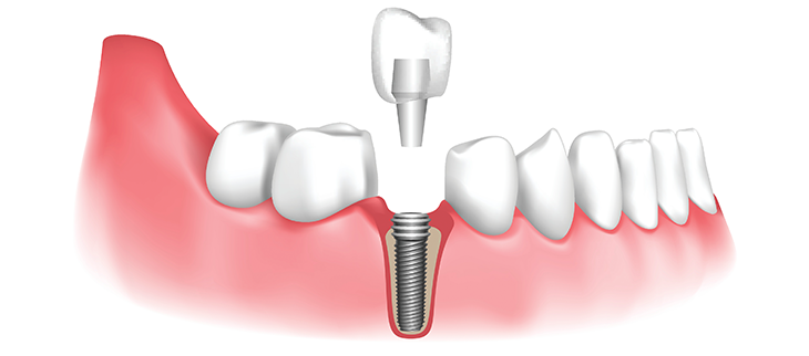 General Family Dentistry