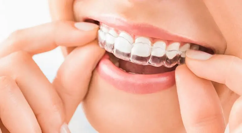 General Family Dentistry