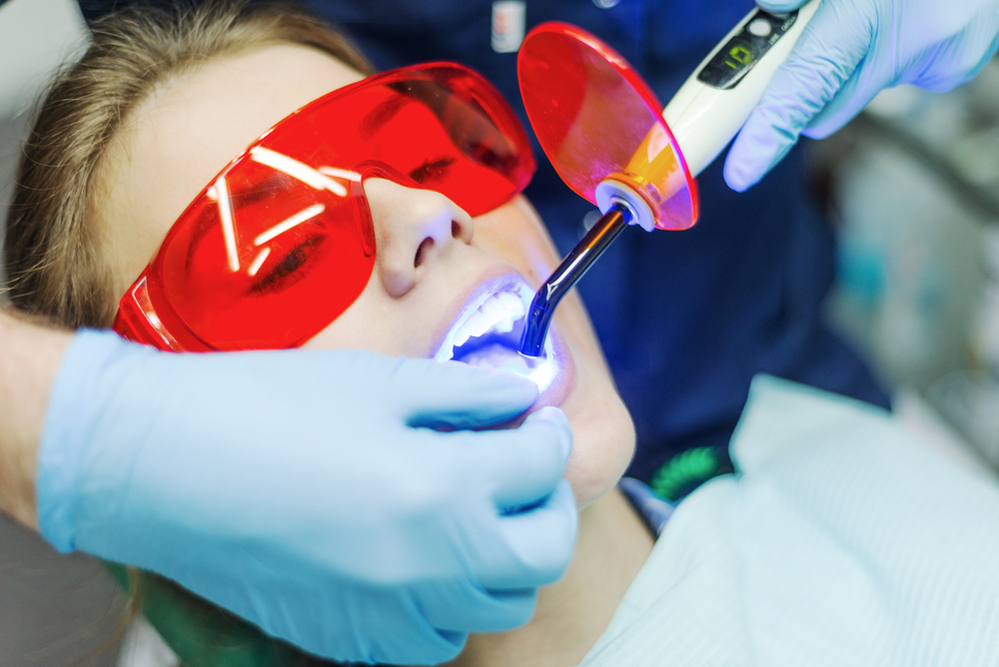 Gentle, Drill-Free, Injection-Free Cavity Treatment