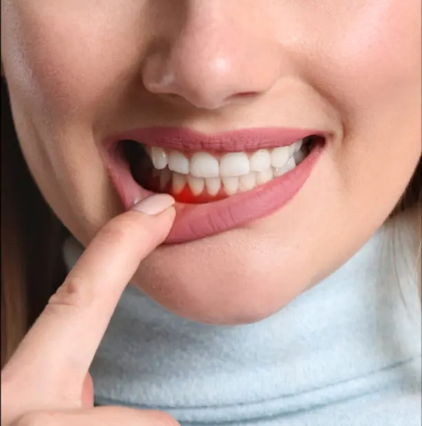 Oral cancer screening examination
