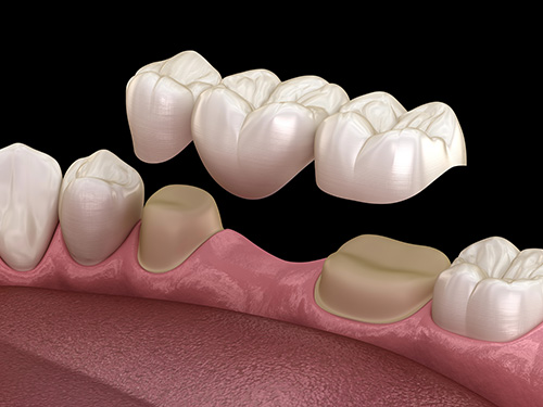Cosmetic Dentistry