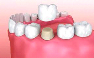 Cosmetic Dentistry