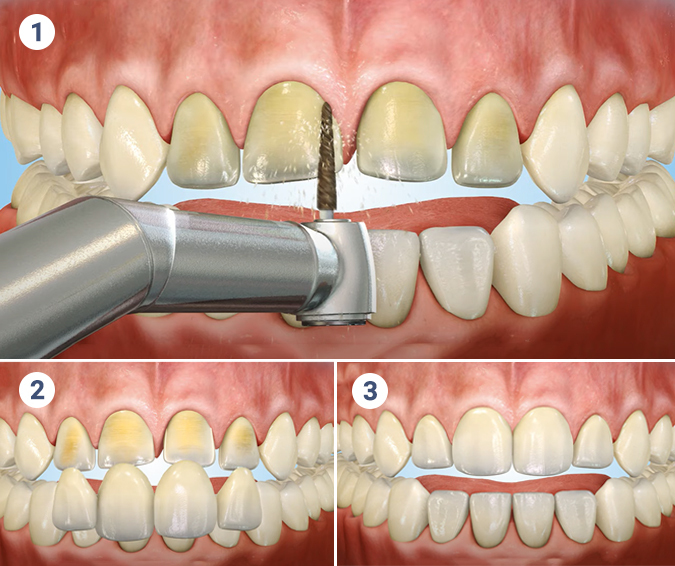 Cosmetic Dentistry