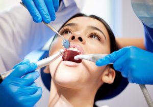 Top Reasons to Never Skip Your Regular Dental Check-ups
