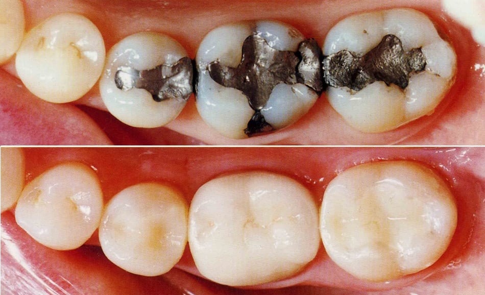 Cosmetic Dentistry