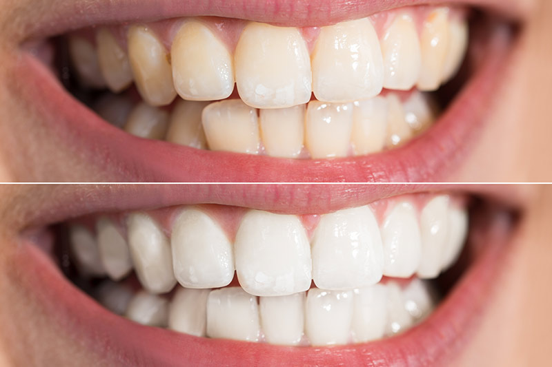 Cosmetic Dentistry