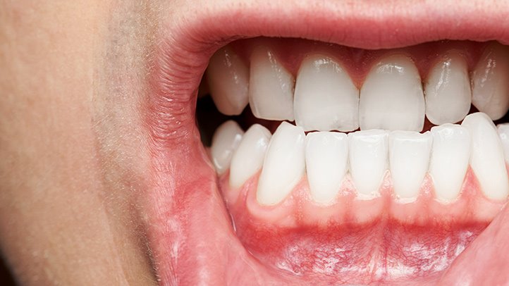 General Family Dentistry