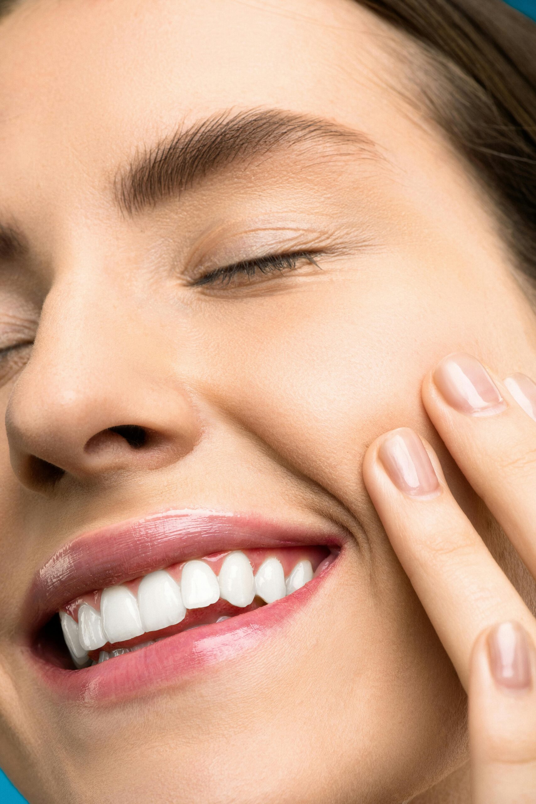 Bright, whitened smile after ZOOM whitening